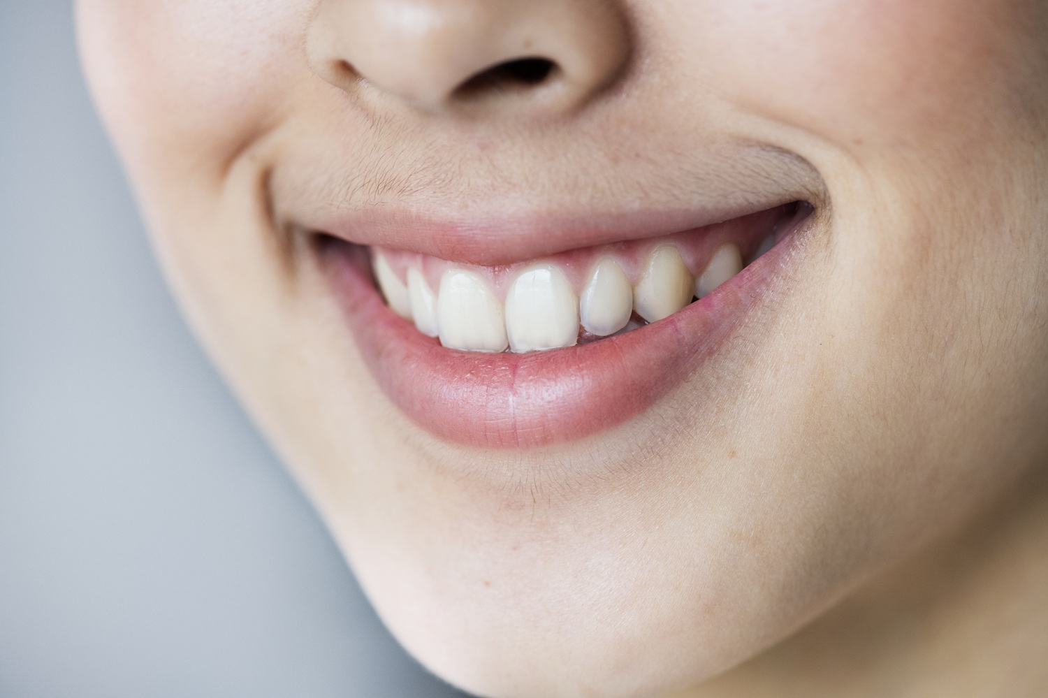 Paciente despues de una sesión de blanqueamiento dental